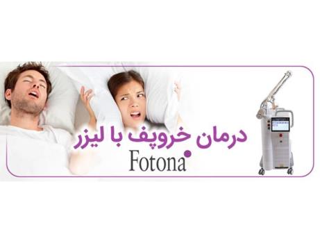 درمان قطعی خروپف با لیزر فوتونا